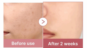 medicube PDRN Pink Collagen Exosome Shot Serum 7,500 3