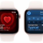 Apple Watch Series 10 1