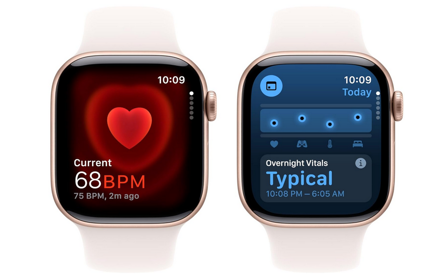 Apple Watch Series 10 1